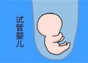 培养杭州捐卵宝宝艺术细胞的小技巧